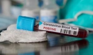 1749637638_Corona-Positive.jpg